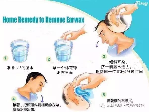 耳畸形护理