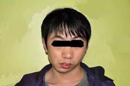 耳畸形引发面部缺陷,我们该怎么办