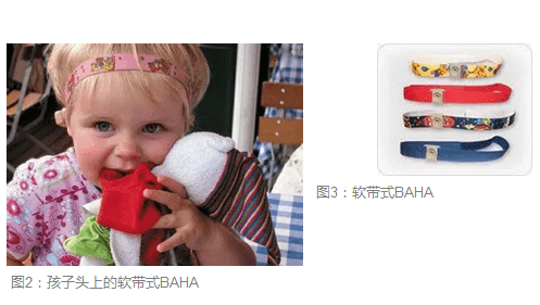 耳畸形听力