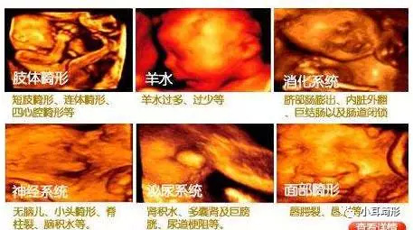 宝妈不幸生下了一个耳畸形的宝宝,谁该为此负责