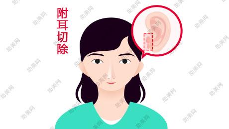 副耳