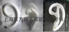 医学生物材料Medpor,你了解多少