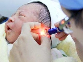 耳畸形带来的听力损失及听力筛查方法